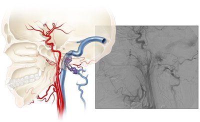 Minimally Invasive Neurosurgery Clinic