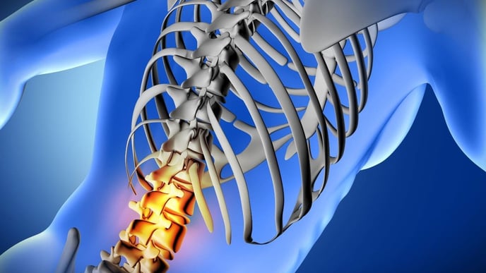 3D visualization of a spinal cord injury