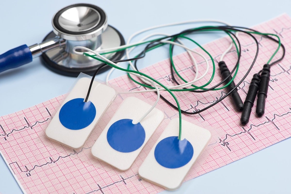 Stethoscope, ECG electrodes with wires, and heart rate chart on blue surface.