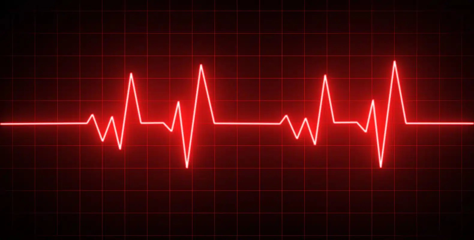 Red electrocardiogram (ECG) line displaying heartbeats on a black background with a grid pattern.