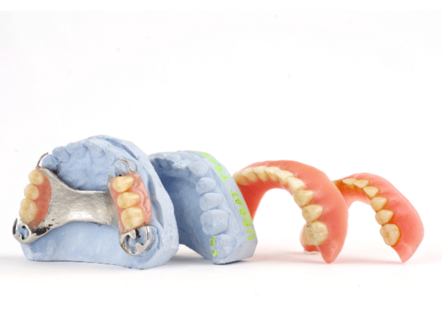 Types and Benefits of Dentures