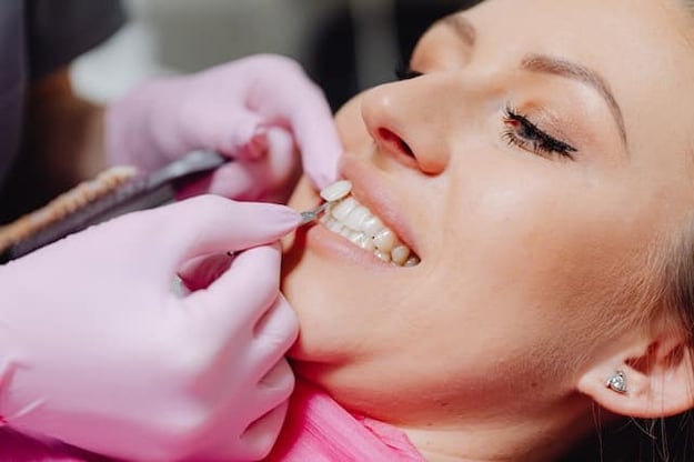 The Top 5 Questions About Veneers, Answered by a Cosmetic Dentist
