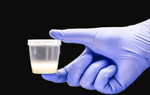 Sperm Donation: Modern World - Modern Pregnancy Opportunities