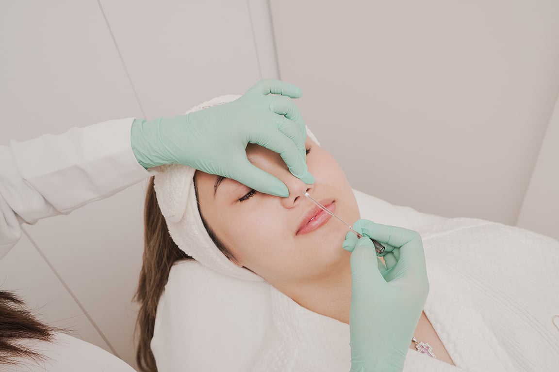 MOLD Manila's HIKO Nose Thread Lift - <i>Non-surgical nose thread life</i>