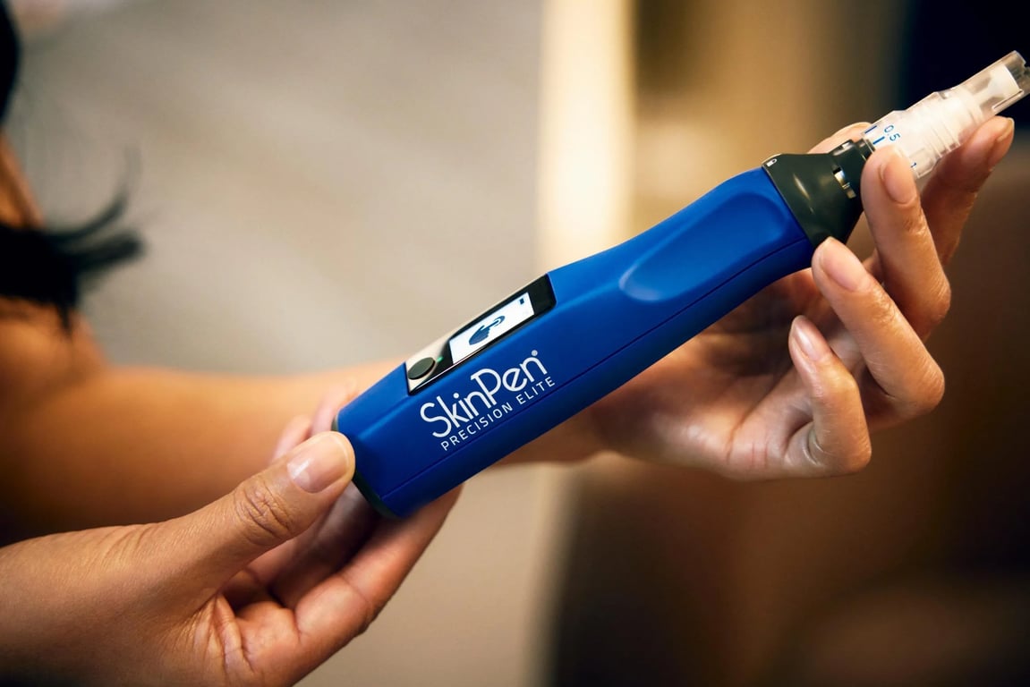 Professional SkinPen Treatment