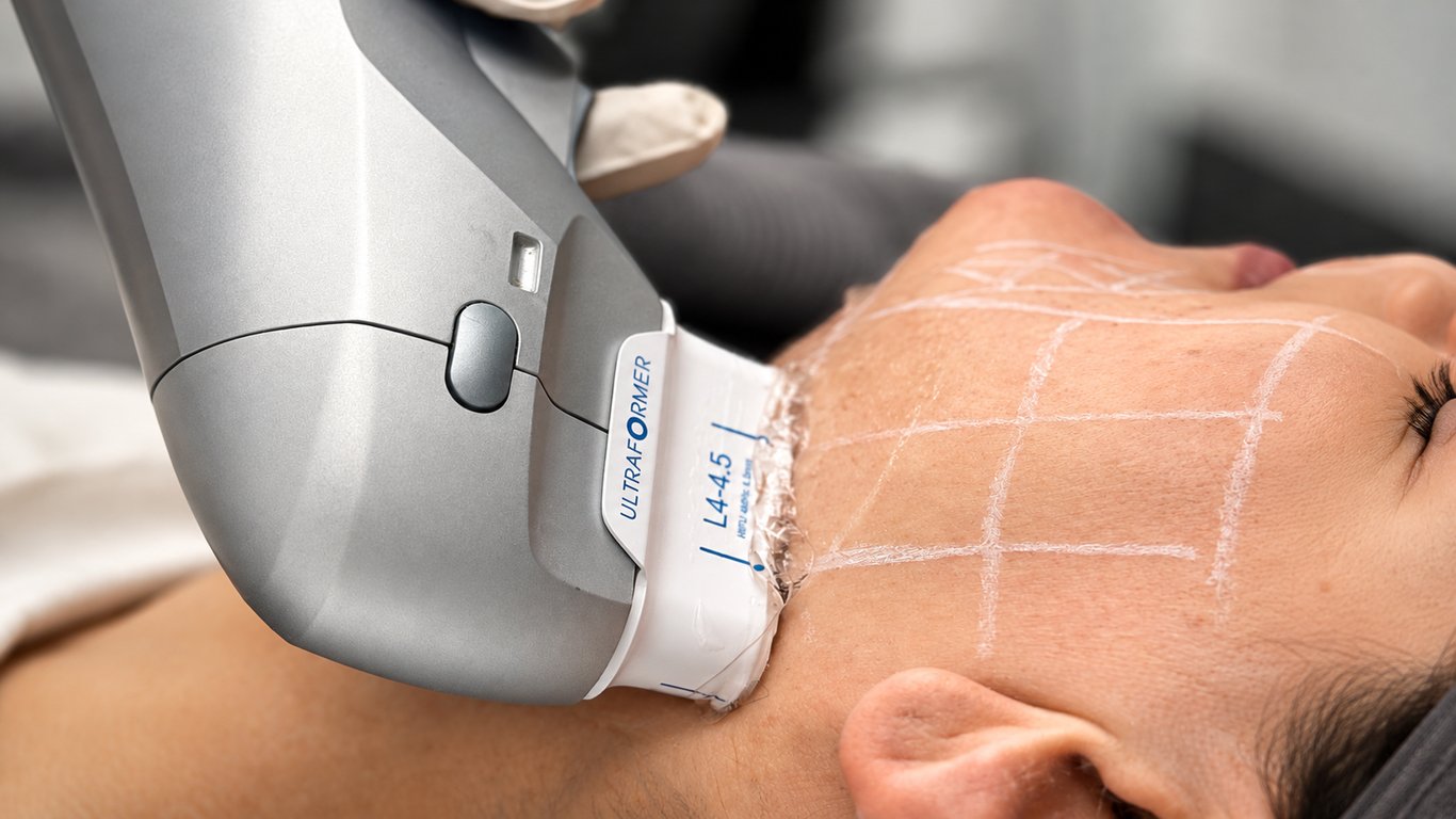 Ultraformer Facial Skin Tightening Treatment