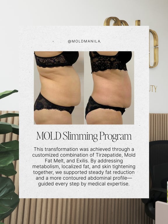 Non-Surgical Skin Tightening Alternatives Gain Ground in the Philippines, Says Medical Experts | PR