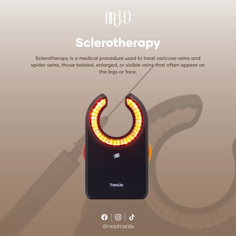 Mold Manila | Sclerotherapy