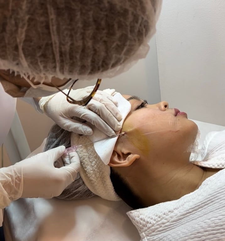 Cog Face Thread Lift