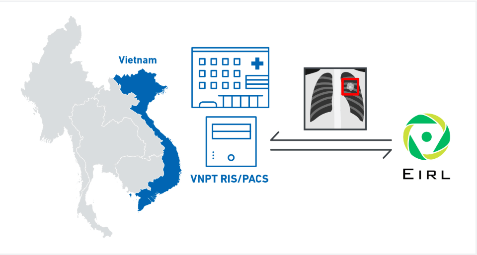 LPIXEL จับมือ VNPT-IT เป็นพันธมิตรเพื่อให้บริการ AI สำหรับสนับสนุนการวินิจฉัยจากภาพทางการแพทย์ “EIRL” ในประเทศเวียดนาม
