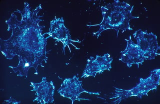 cancer cells | Longevity LIVE