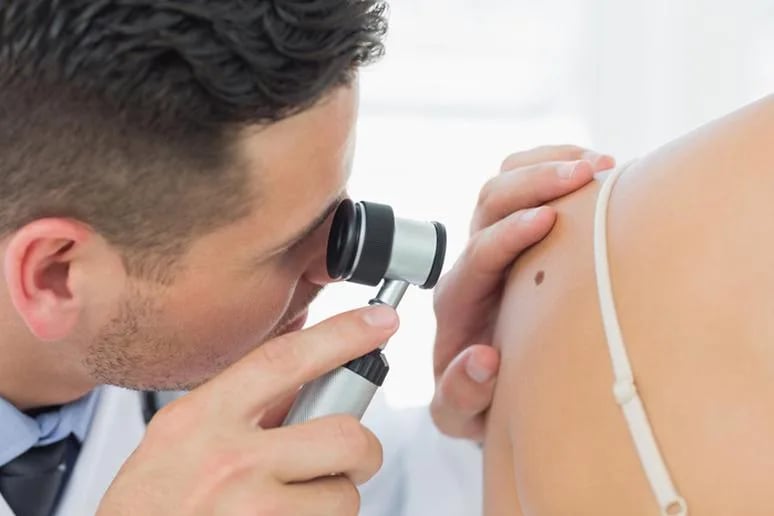 Preventing Skin Cancer: 6 Simple Tips to Follow