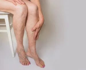 8 Tips to Tackle Leg Pain Caused by Diabetes