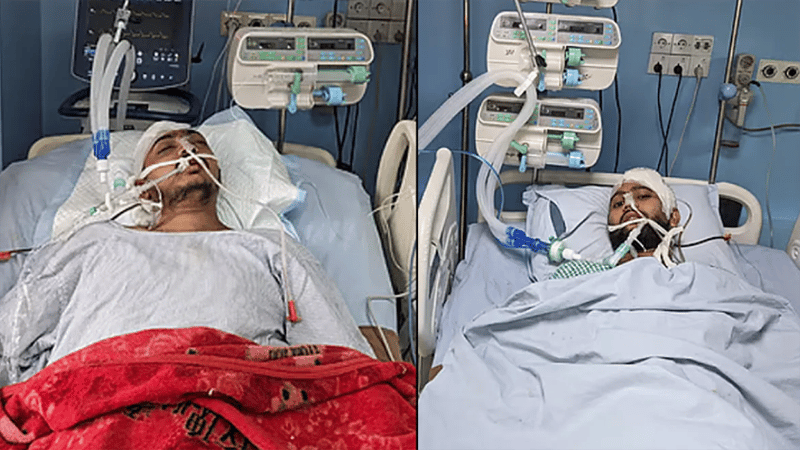 2 CU students on life support after clash with locals