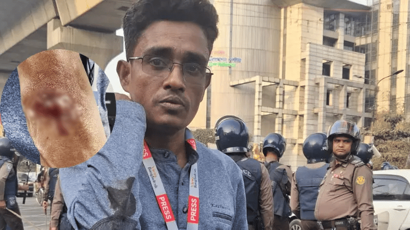 Police baton charge at Inquilab Mancha event, Views Bangladesh reporter wounded