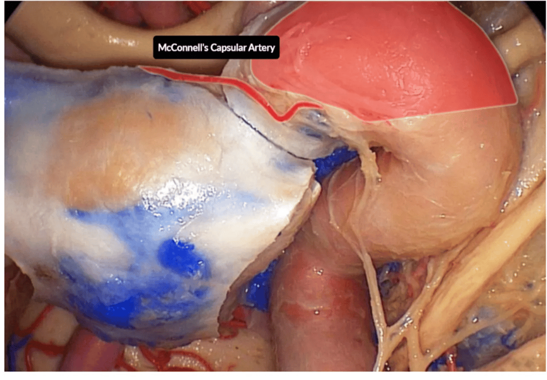 Endoscopic anterior view of the sellar region and left internal carotid artery and cavernous sinus 