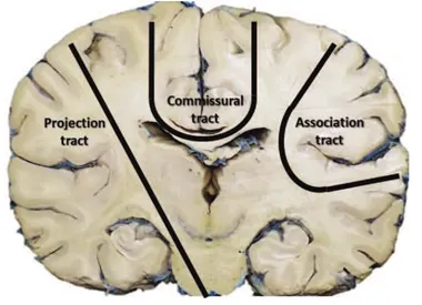 Types of white matter tracts