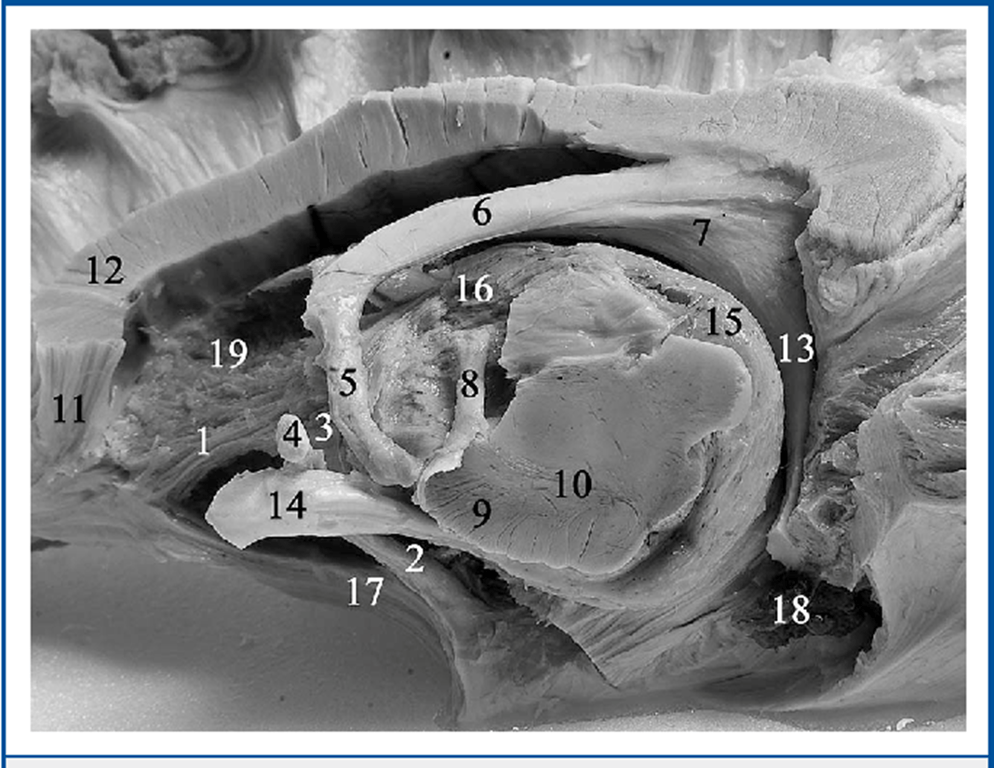 Inferomedial view of the right hemisphere. Anterior commissure: 1, anterior limb of the anterior commissure (AC); 2, lateral (temporal) limb of the AC; 3, canal of Gratiolet; 4, corpus of the AC; Fornix: 5, anterior column of the fornix; 6, corpus of the fornix; 7, psalterium of the fornix; 13, posterior column of the fornix; 8, mammillothalamic tract (of Vicq d’Azyr); 9, pes pedunculi; 10, locus niger; Corpus callosum: 11, ventral radiations of the corpus callosum; 12, genu of the corpus callosum; 14, optic chiasma; 15, pulvinar; 16, thalamus; 17, uncinate fasciculus; 18, choroid plexus; 19, head of the caudate nucleus. 