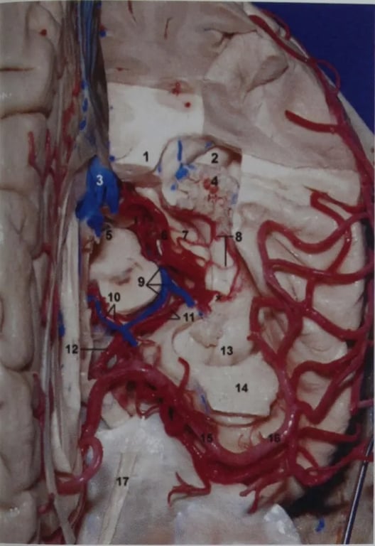 Anterior superior view