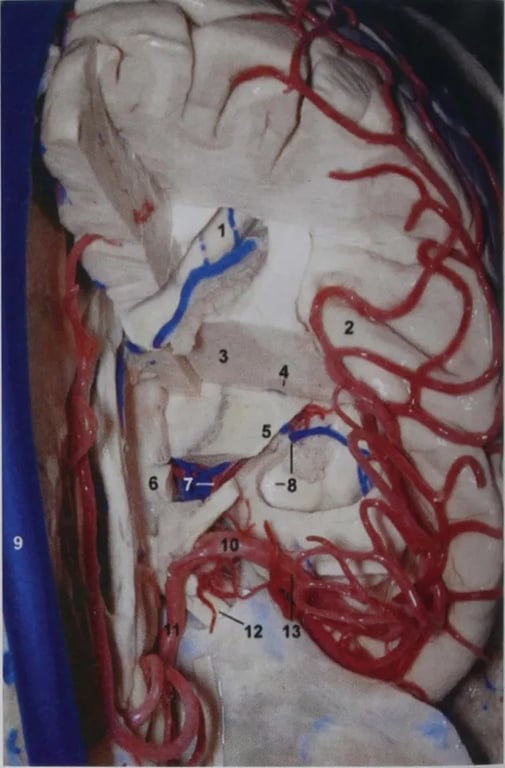 Anterior superior view