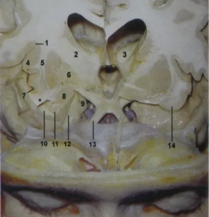 Coronal cut at the level of the optic chiasm on the left side of the specimen. 
Coronal cut at the level of the foramen of Monro and the apex of the uncus on the right side of the specimen