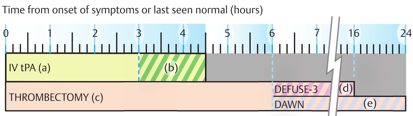 (a) IV tPA: give to essentially all candidates within 4.5 hours of onset (NICE)
(b) 3–4.5 hrs: IV tPA reasonable but not studied in same patient population
(c) thrombectomy candidates: NIHHS score ≥ 6; ASPECTS ≥ 6; Large vessel occlusion (LVO); Puncture ≤ 6 hrs from onset (NICE), within 6-24hrs of wake up strokes
(d) Thrombectomy 6–16 hrs in candidates who meet other DAWN or DEFUSE-3 (p.1356) eligibility
(e) Thrombectomy 16–24 hrs in candidates with anterior circulation LVO who meet other DAWN eligibility criteria