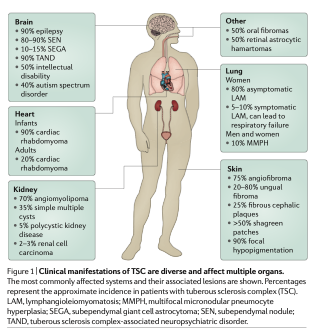 DOI 10.1038/nrdp.2016.35