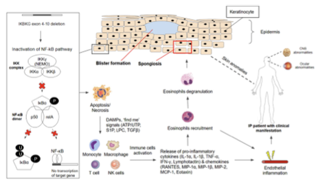 DOI doi:10.1038/nrdp.2016.35