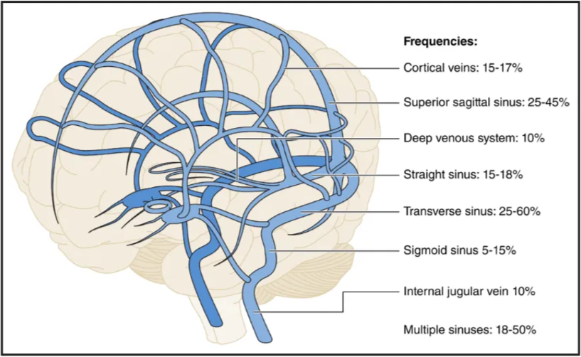 Anatomy of the cerebral venous system and distribution of CVT: Prevalence of sinus involvement in CVT. Percentages may be >100% because many patients may have >1 sinus involved. Please note that internal jugular vein thrombosis represents its concomitant prevalence with CVT (not in isolation). 