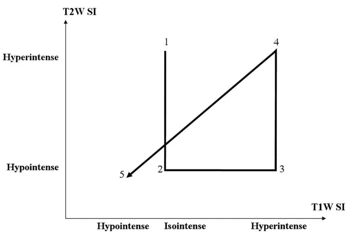 Mnemonic graph describing the progression of MRI signal intensity changes of intracranial hemorrhage