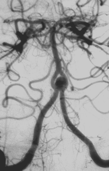 An x-ray of a brain AI-generated content may be incorrect.