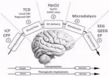 Multimodal monitoring • CBF monitoring (theoretically superior) CT perfusion - CPP < 7()mmHg tends to be associated cerebral infarction Brain-tissue oxygen catheter - Cerebral metabolism (microdialysis) • Vessel diameter assessment Transcranial Doppler - Conventional angiography - CT angiography Pbt02 GEEG 