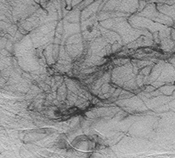 A close-up of hair AI-generated content may be incorrect.