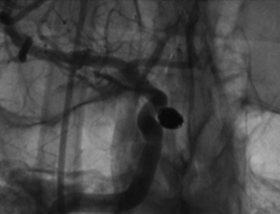 An x-ray of a human body AI-generated content may be incorrect.