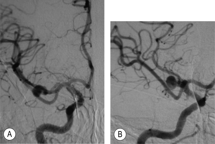 A close-up of a brain AI-generated content may be incorrect.