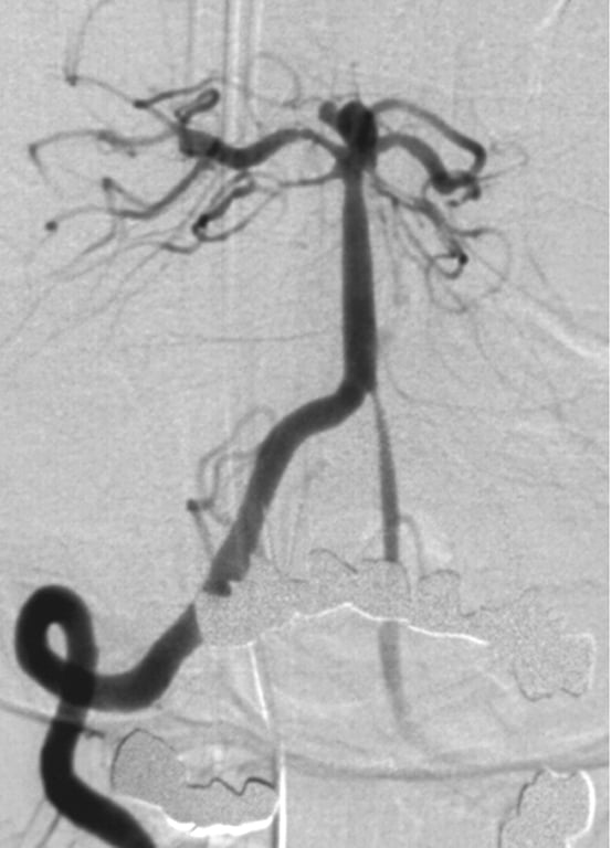 An x-ray of a brain AI-generated content may be incorrect.