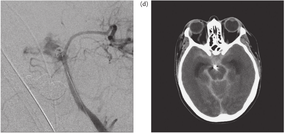 A close-up of an x-ray AI-generated content may be incorrect.