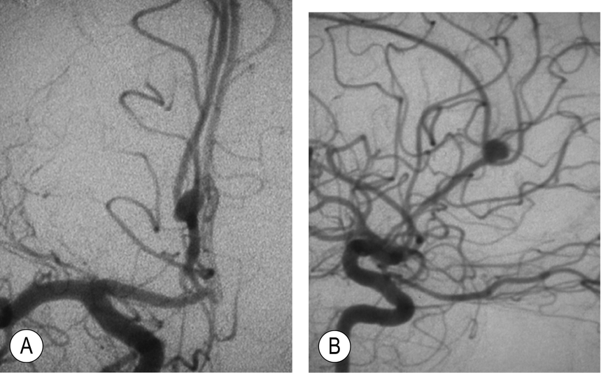 A close-up of a brain AI-generated content may be incorrect.