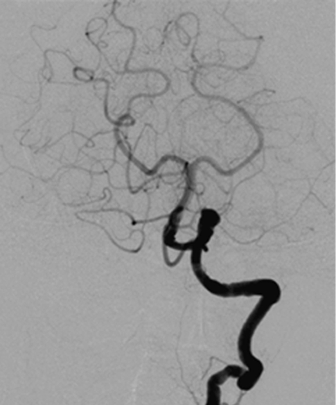 An x-ray of a brain AI-generated content may be incorrect.