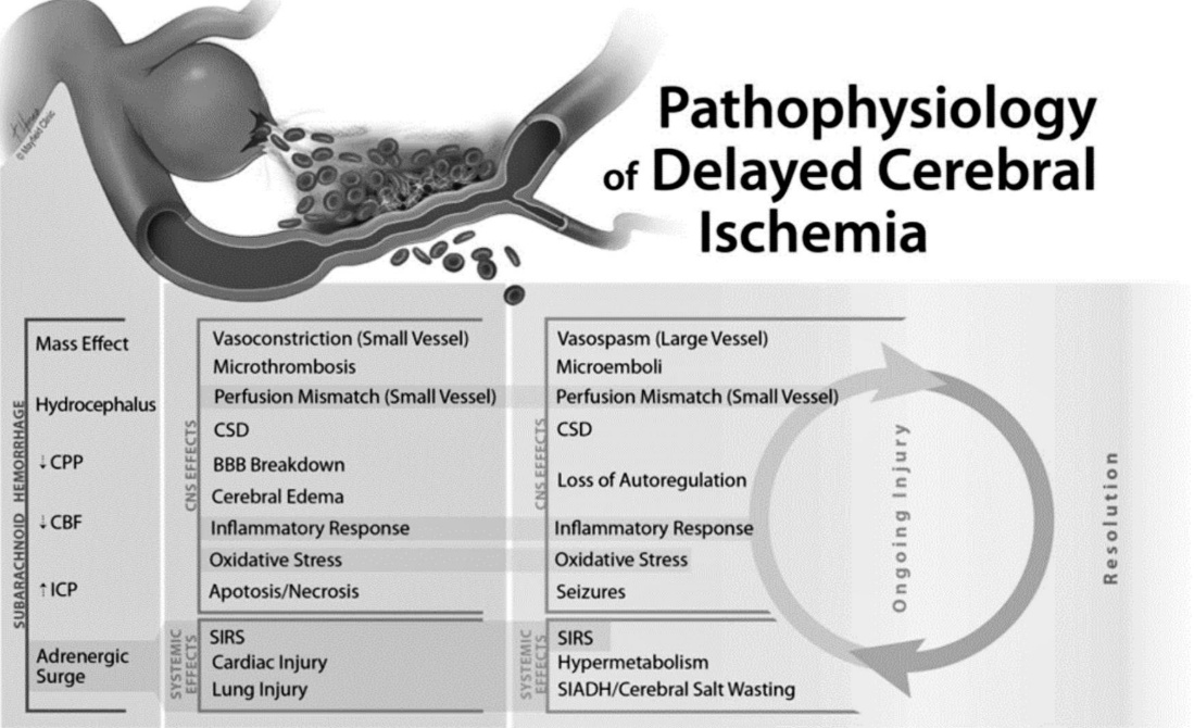 Pathophysiology of Delayed Cerebral Ischemia Vasospasm (Large Vessel) Mass Effect Hydrocephalus CPP CBF ICP Adrenergic Surge Vasoconstriction (Small Vessel) Microthrombosis Perfusion Mismatch (Small Vessel) CSD BBB Breakdown Cerebral Edema Inflammatory Response Oxidative Stress Apotosis/Necrosis SIRS Cardiac Injury Lung Injury Microemboli Perfusion Mismatch (Small Vessel) CSD Loss of Autoregulation Inflammatory Response Oxidative Stress Seizures SIRS Hypermetabolism SIADH/Cerebral Salt Wasting o c o 