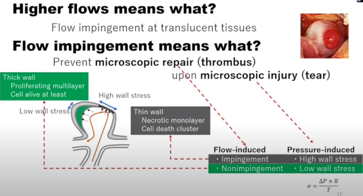 Higher flows means what? Flow impingement at translucent tissues Flow impingement means what? microscopic reRair (thrombus) upon microscopic injury (tear) Thick wall Proliferating multilayer Cell alive at least Low w41 stres High wall stress Thin wall Necrotic monolayer Cell death cluster Flow-induced Pressure-induced • High wall stress • Impingement • Low wall stress • Nonimpingement 