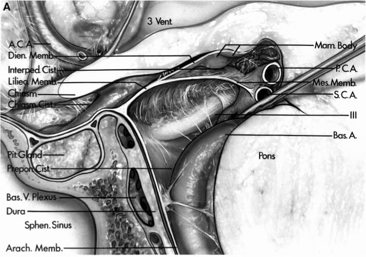 3 . CA SCA Bas A Sphen.s,ntß Arach. Memb. 