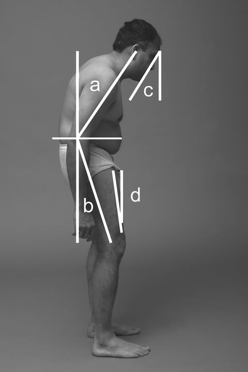 a=tragus angle, b=knee angle, the sum of a and b constitutes WBKA. c=CBVA, d=thigh flexion angle.