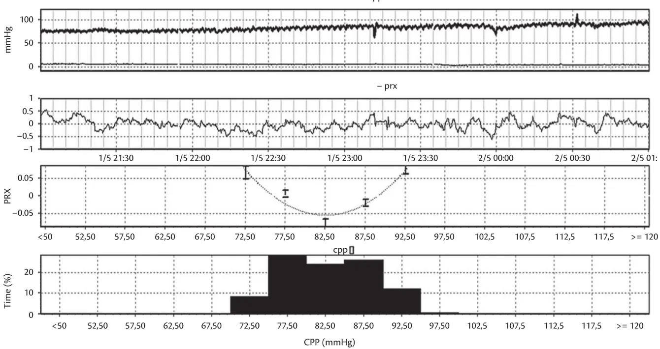Screenshot from ICM+ software panel (Cambridge Enterprise, Cambridge, UK) with 4 h trend charts. Determination of the PRx can guide therapy and allow identify optimal CPP at the individual level (CPPopt). First chart: CPP and ICP; second chart: PRx; third chart: PRx/CPP plot for evaluating CPPopt; and fourth chart: percentage of the 4-h time period spent within a given CPP interval.