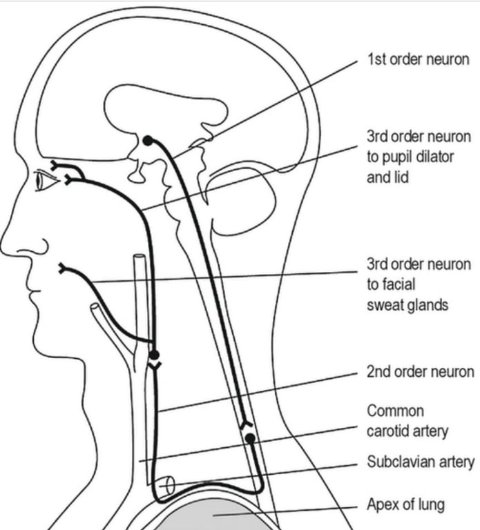 A diagram of the head AI-generated content may be incorrect.
