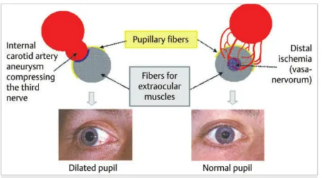 A diagram of eye fibers AI-generated content may be incorrect.