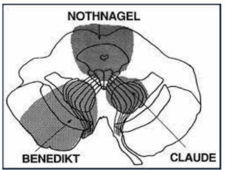 A diagram of the pelvis AI-generated content may be incorrect.