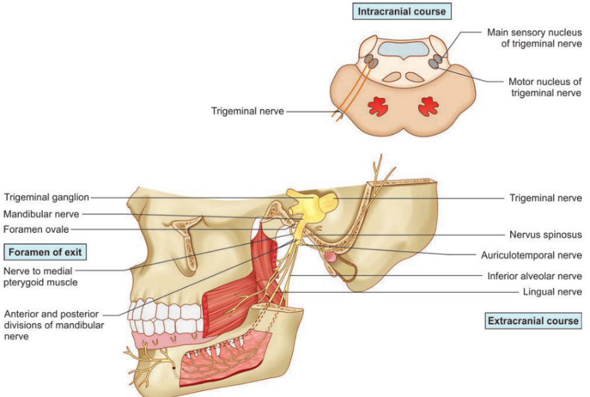 Intracranial course Trigeminal nerve Trigeminal ganglion Mandibular nerve Foramen ovale Foramen Of exit Nerve to medial pterygoid muscle Anterior and posterior divisions Of mandibular Main sensory nucleus Of trigeminal nerve Motor nucleus of trigeminal nerve Trigeminal nerve Nervus spinosus Auriculotemporal nerve Inferior alveolar nerve Lingual nerve Extracranial course 