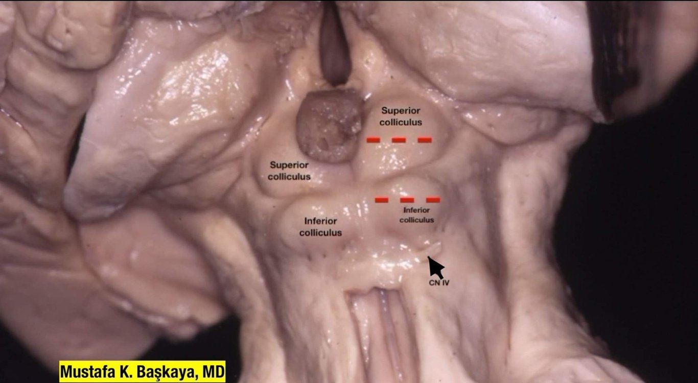 A close-up of the inside of a human body AI-generated content may be incorrect.