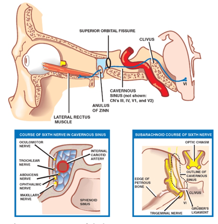 ORBlTAl CAVERNOlJS SlMl.lS .hown: ΑΝΙΙΙυς 0F ΙΙΝΝ l-ATERAl COu9SE 0F %ERVE ΙΝ CAVERNOUS οε SllTH NERVF OPTE c H*sv 